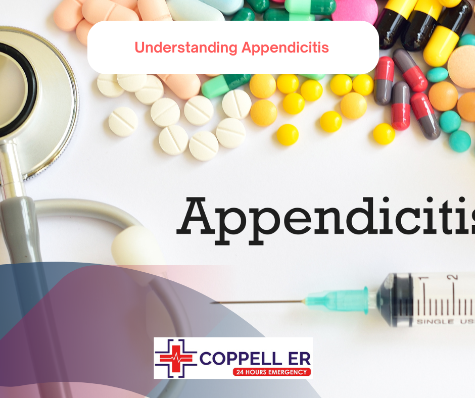 Understanding Appendicitis Coppell ER