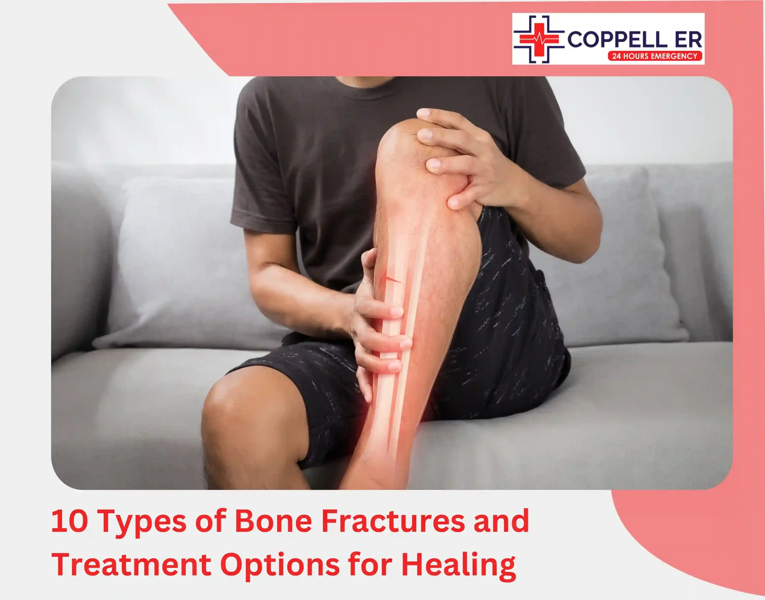 10 Types of Bone Fractures and Treatment Options for Healing