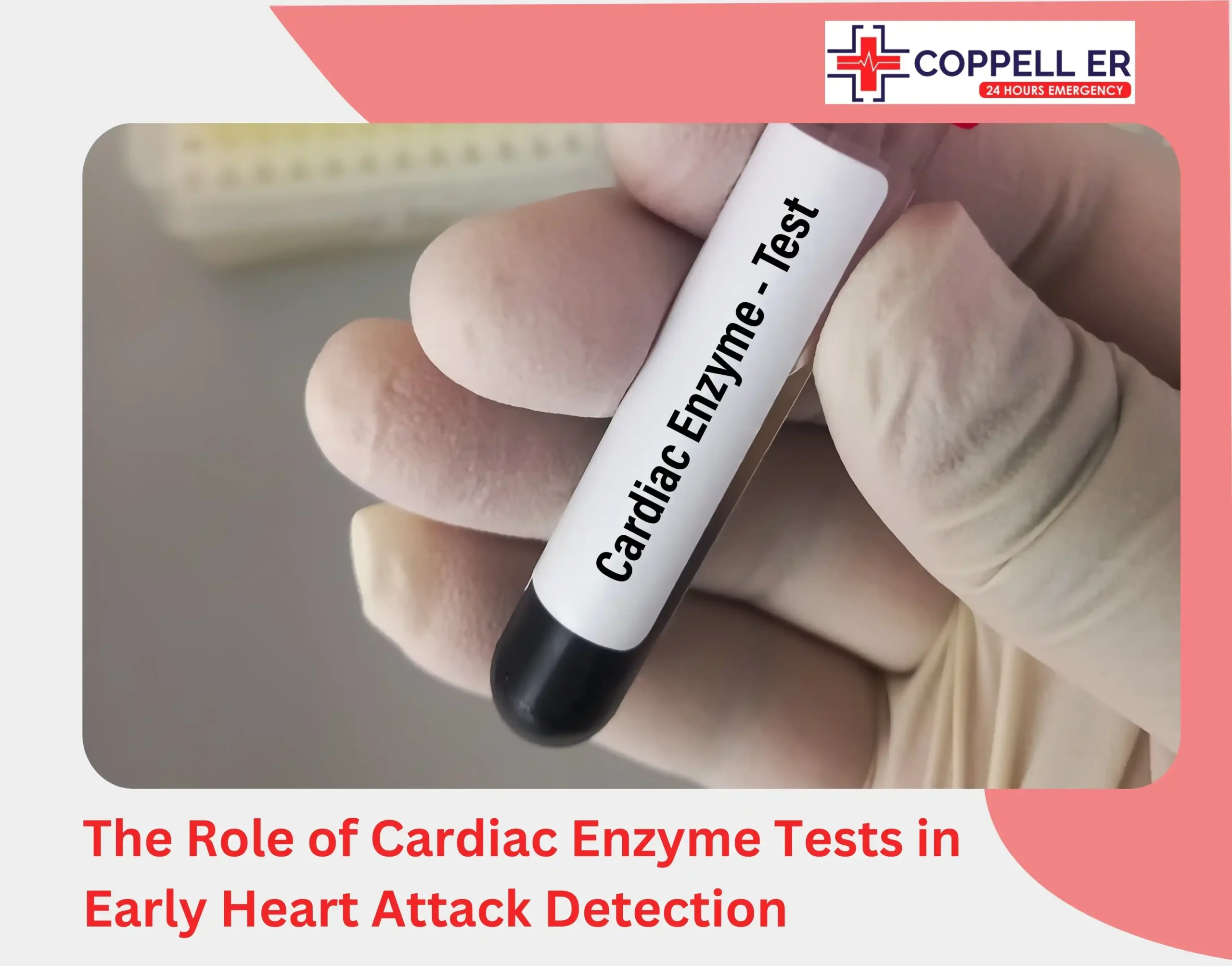 The Role of Cardiac Enzyme Tests in Early Heart Attack Detection