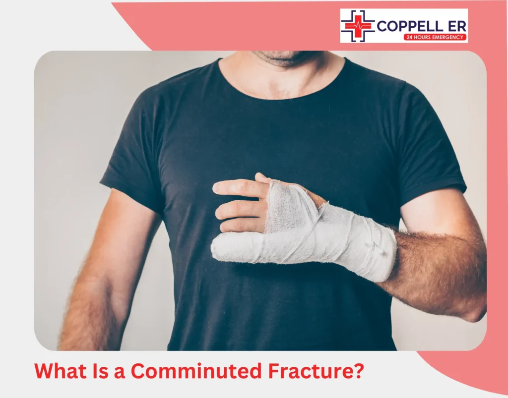 What Is a Comminuted Fracture