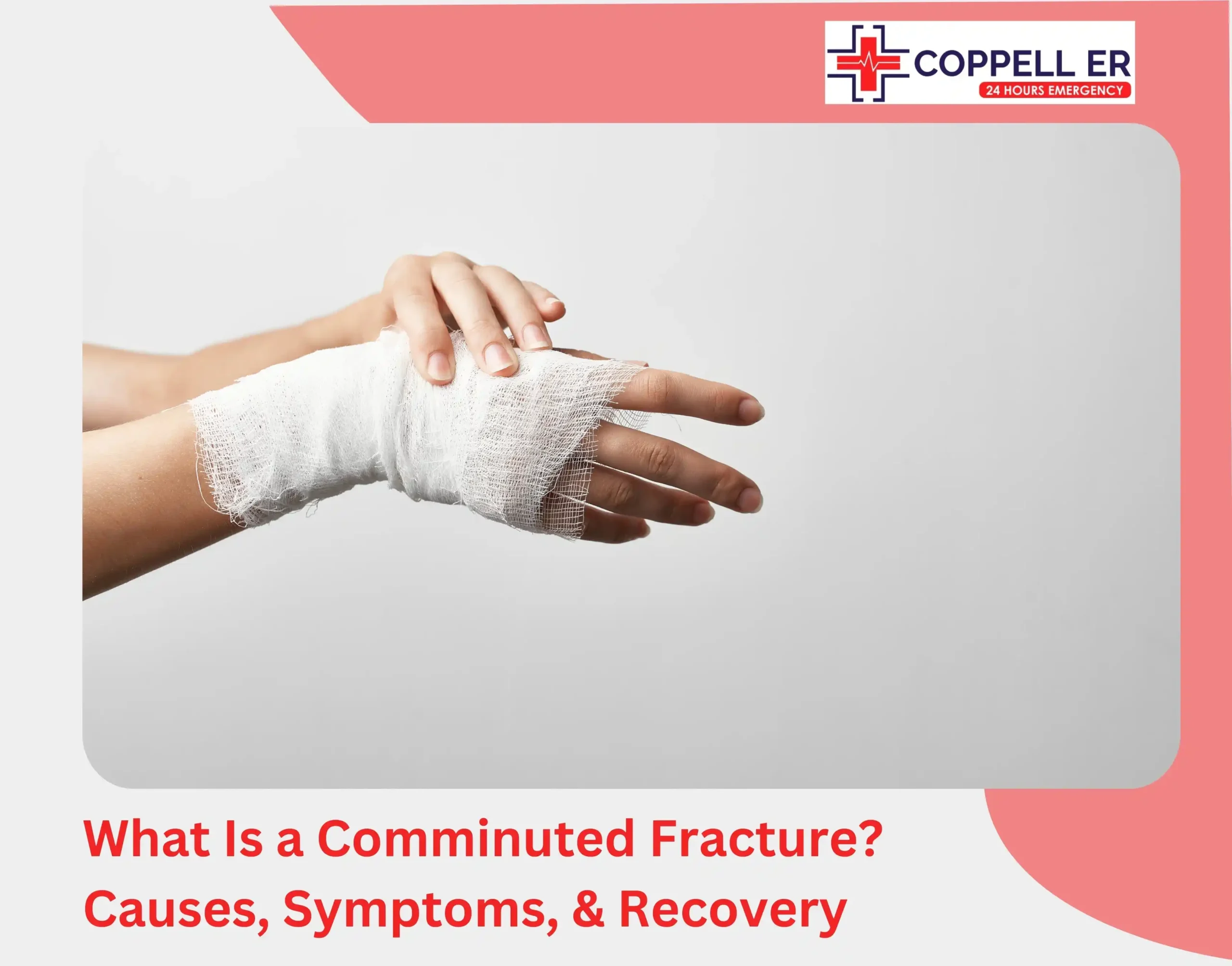 What Is a Comminuted Fracture Causes, Symptoms, & Recovery