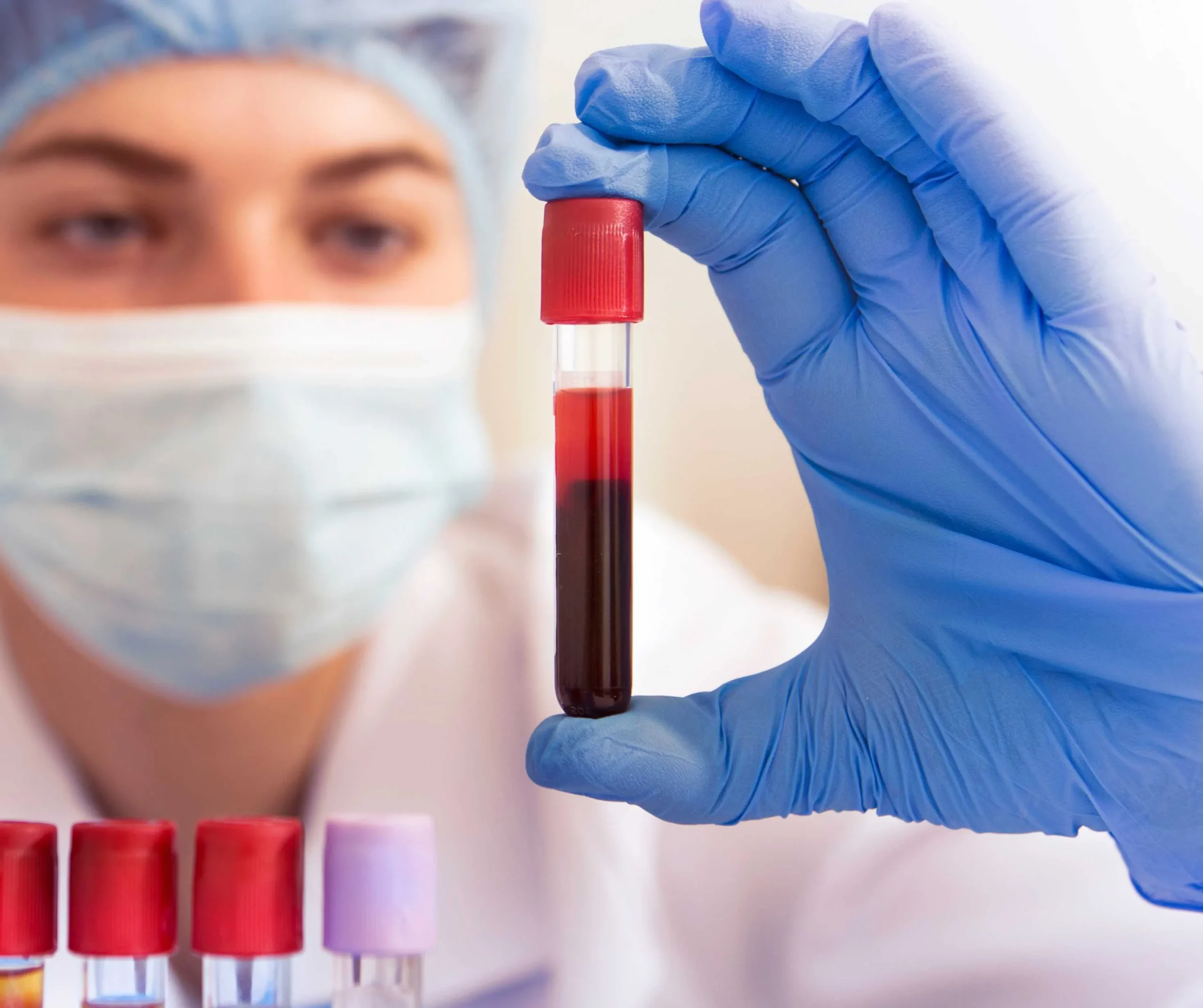 Blood Tests