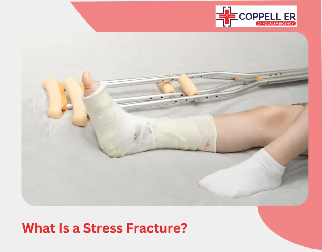 What Is a Stress Fracture