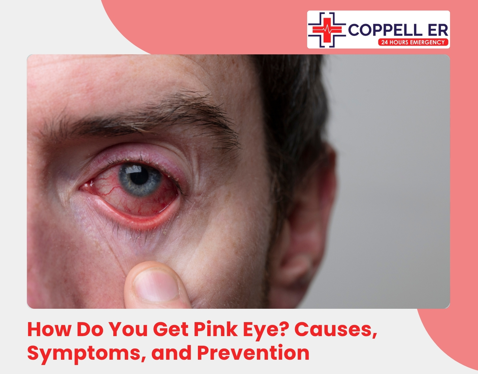 How Do You Get Pink Eye