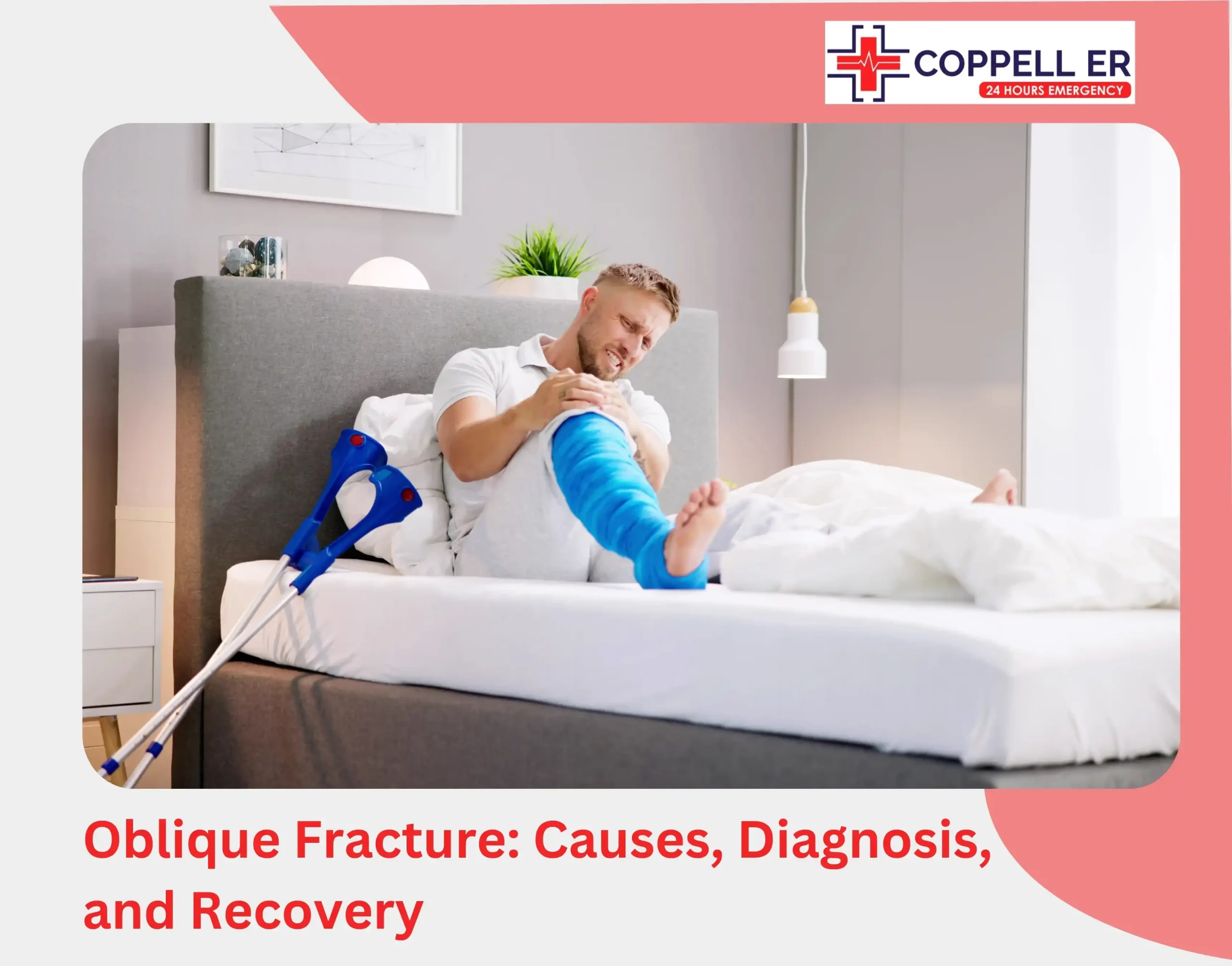 Oblique Fracture Causes, Diagnosis, and Recovery