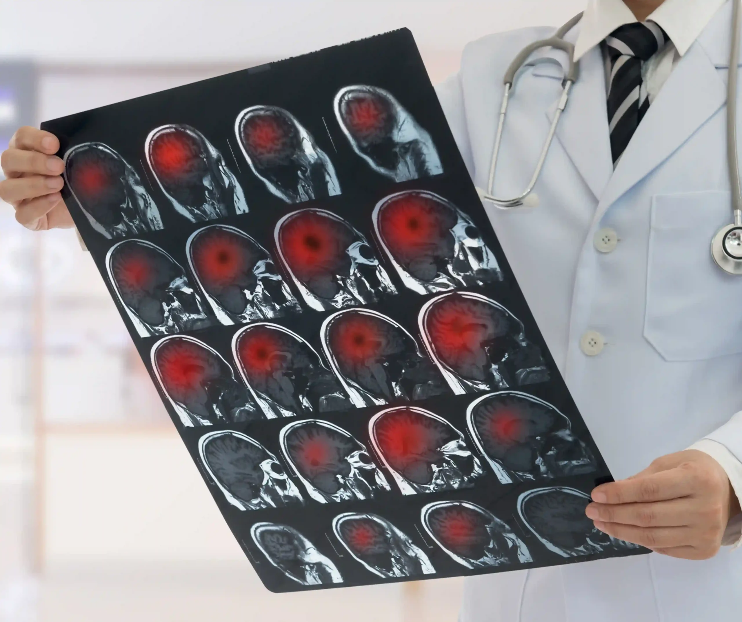 X-Rays Are Appropriate For_11zon