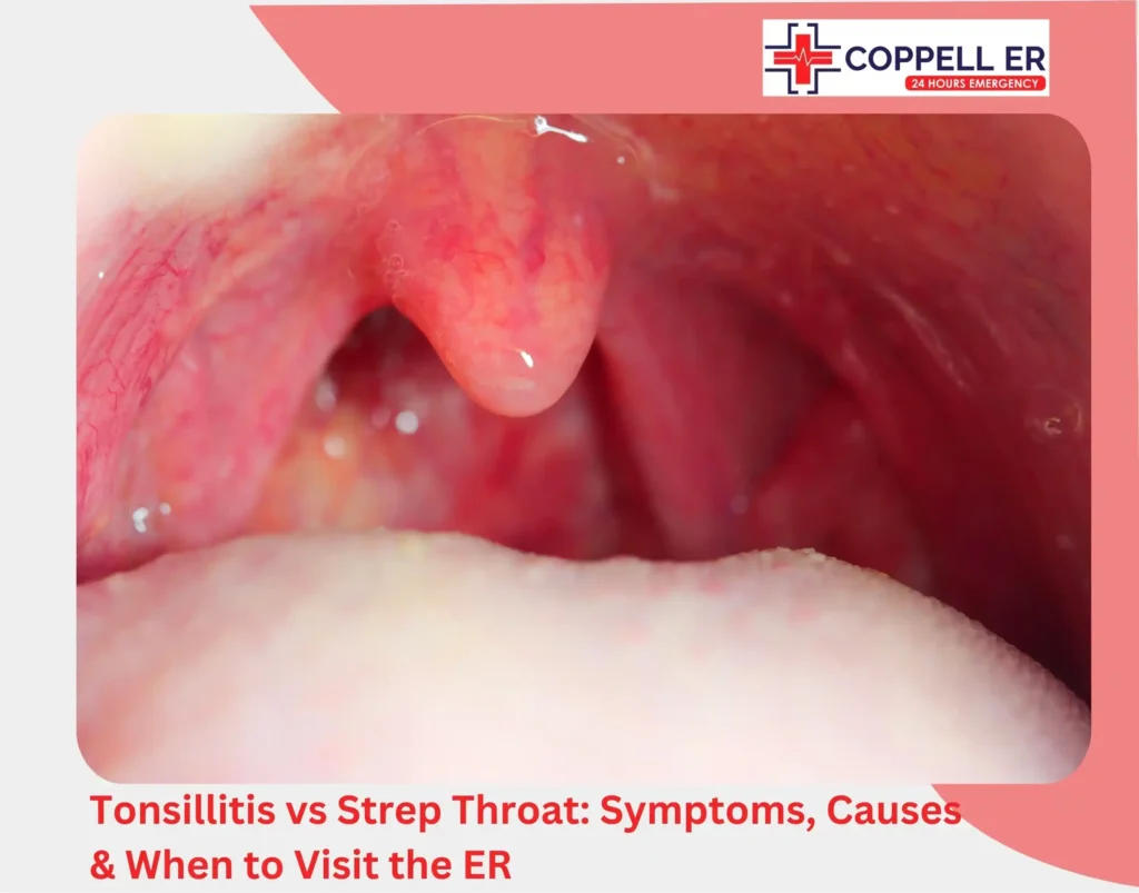 Tonsillitis vs Strep Throat Symptoms, Causes & When to Visit the ER