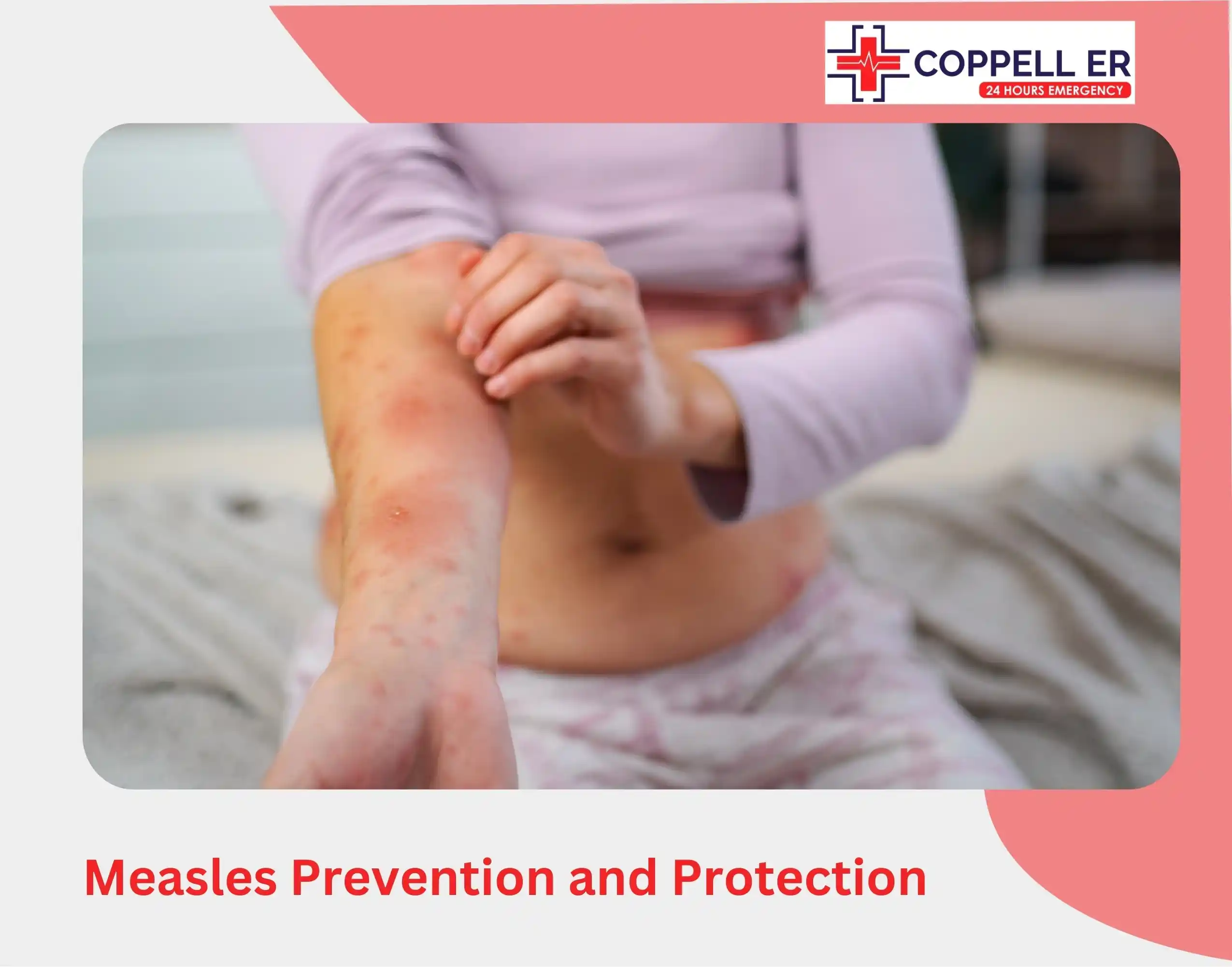 Measles Prevention and Protection