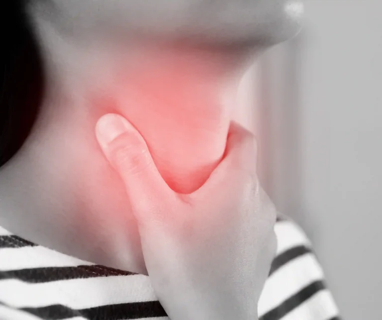 Strep Throat Treatment