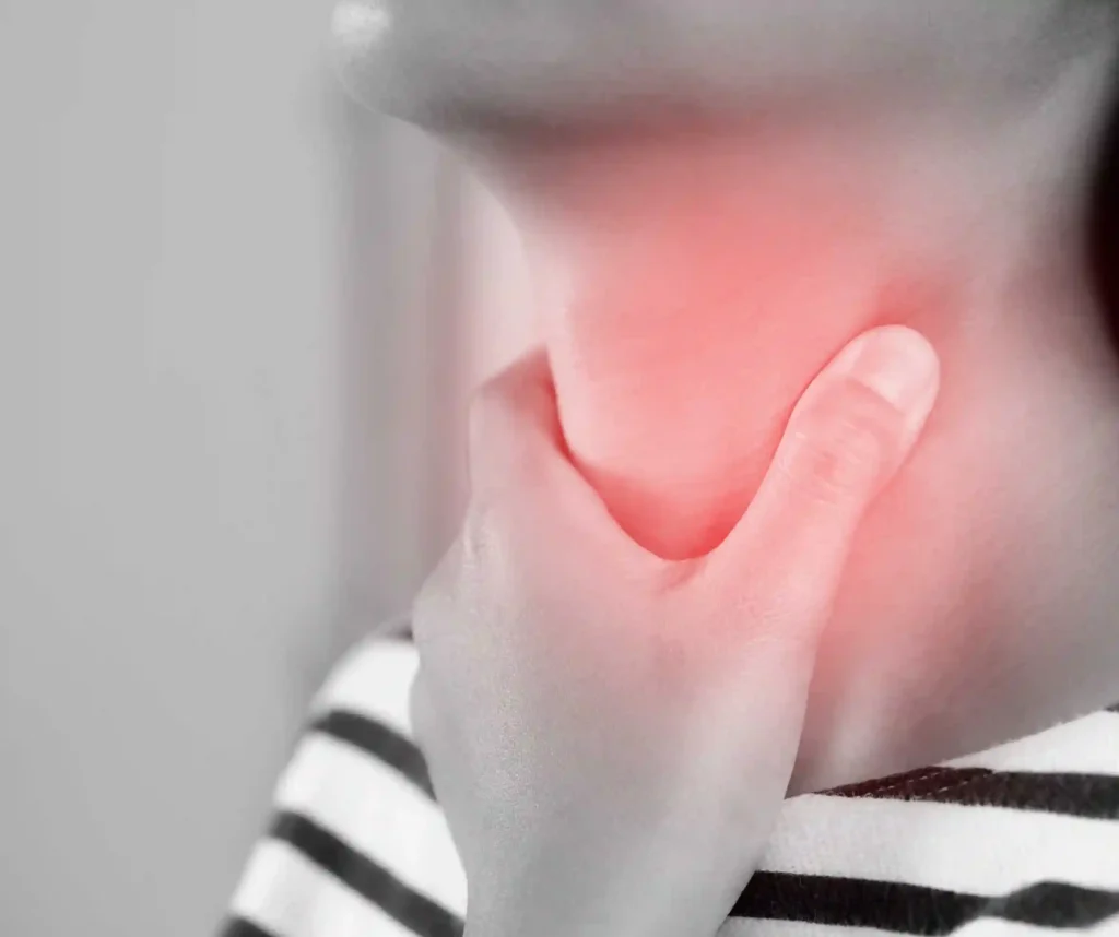 Strep Throat Treatment