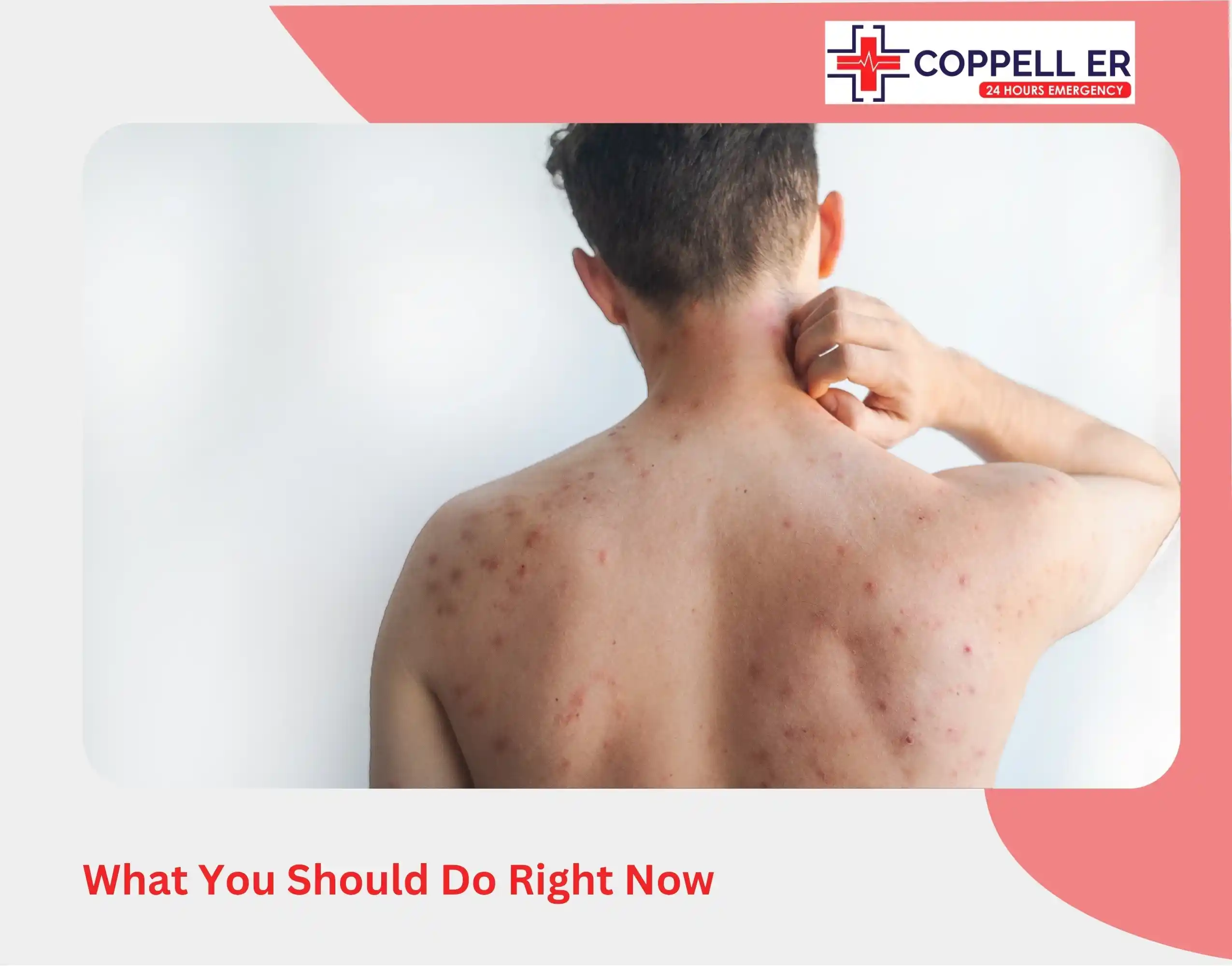 What You Should Do Right Now