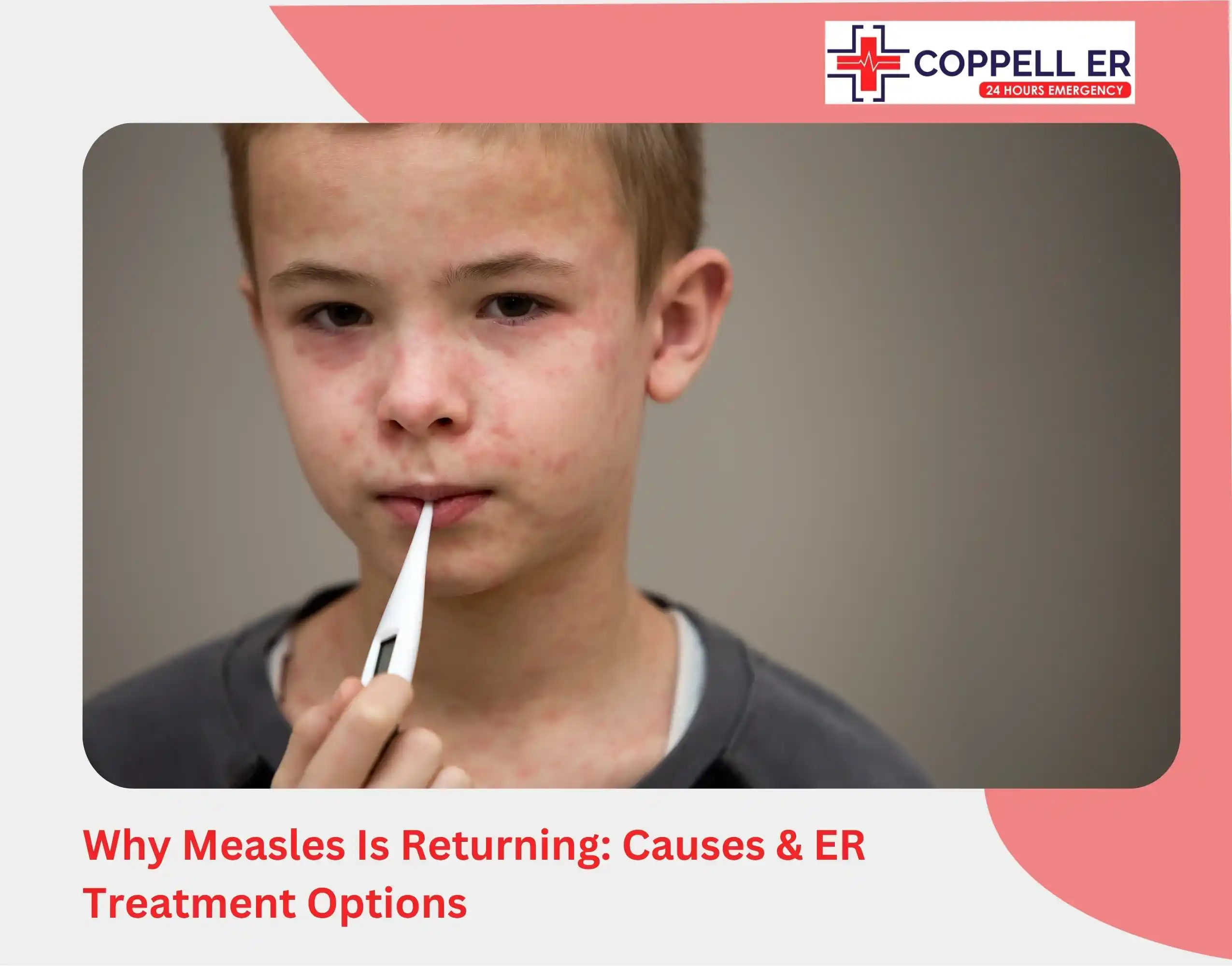 Why Measles Is Returning Causes & ER Treatment Options