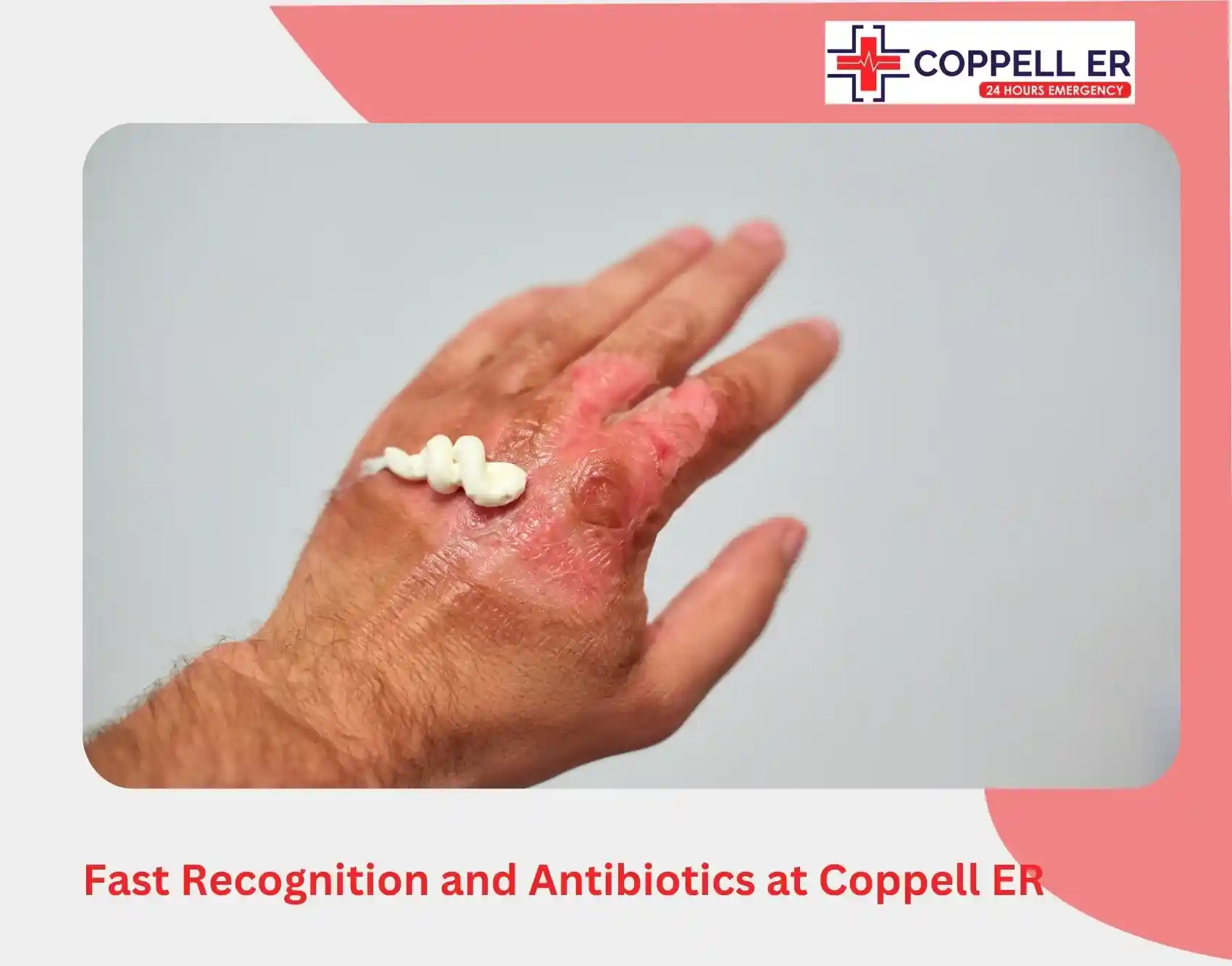 Fast Recognition and Antibiotics at Coppell ER