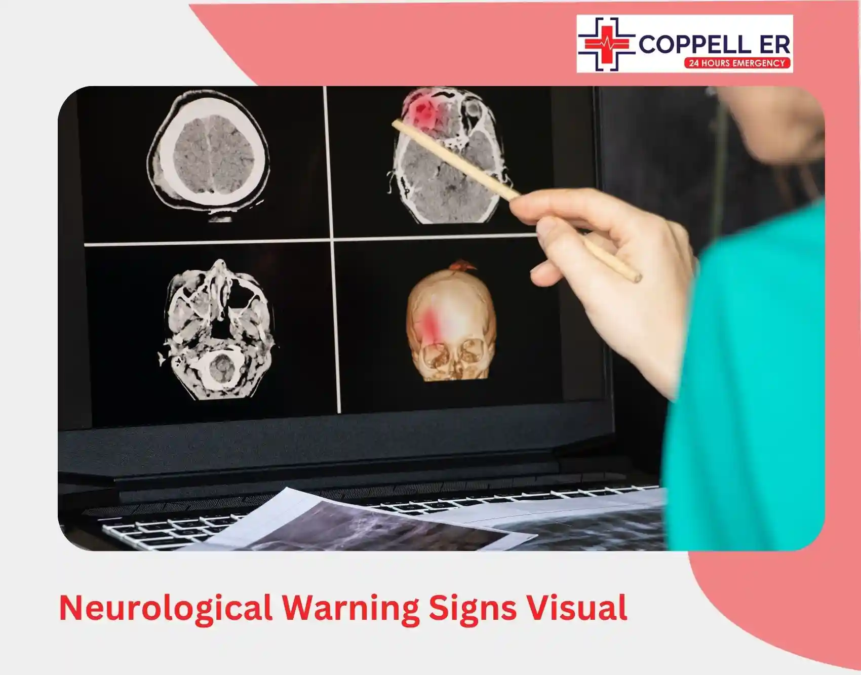 signs of brain bleeding