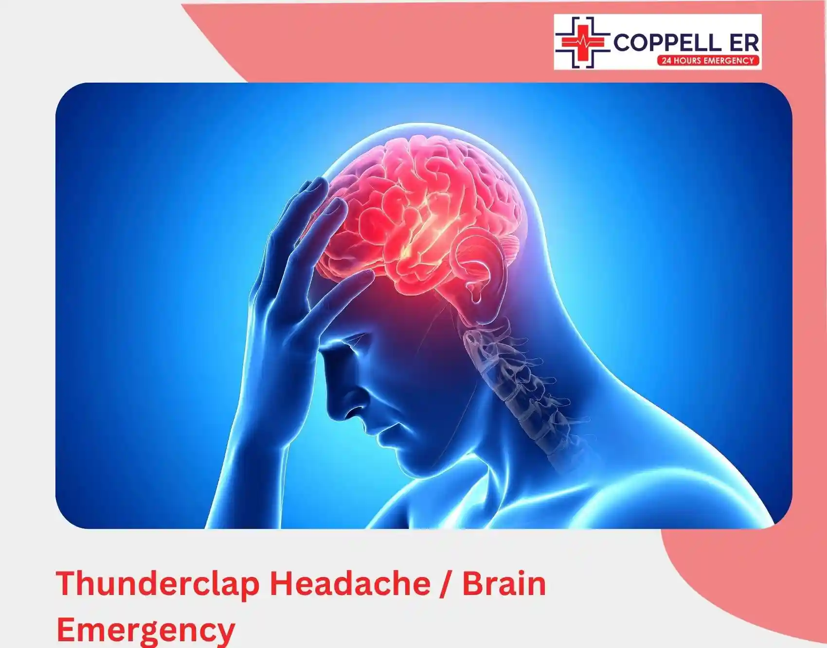 Thunderclap headache and brain emergency medical illustration