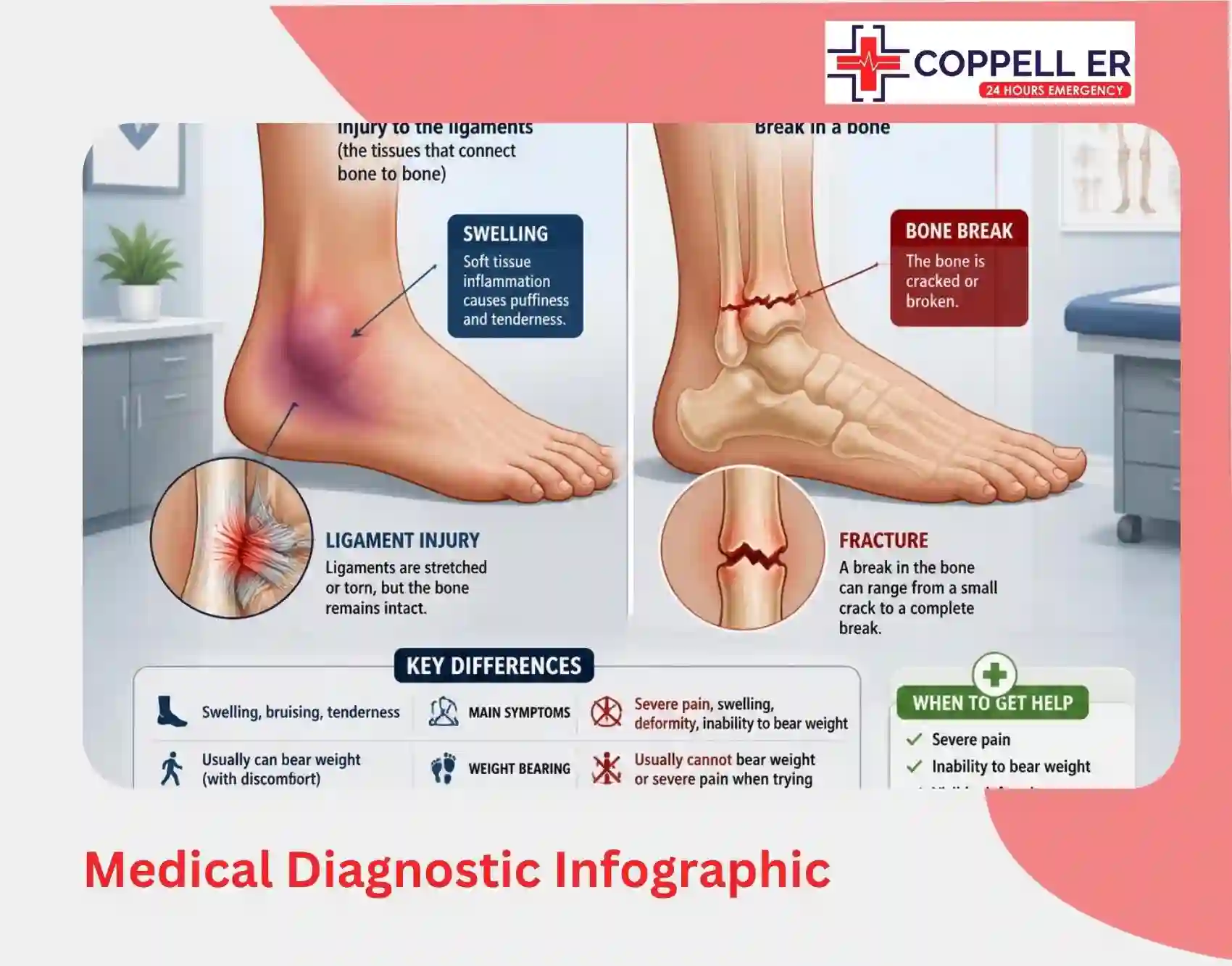 broken bone vs sprain