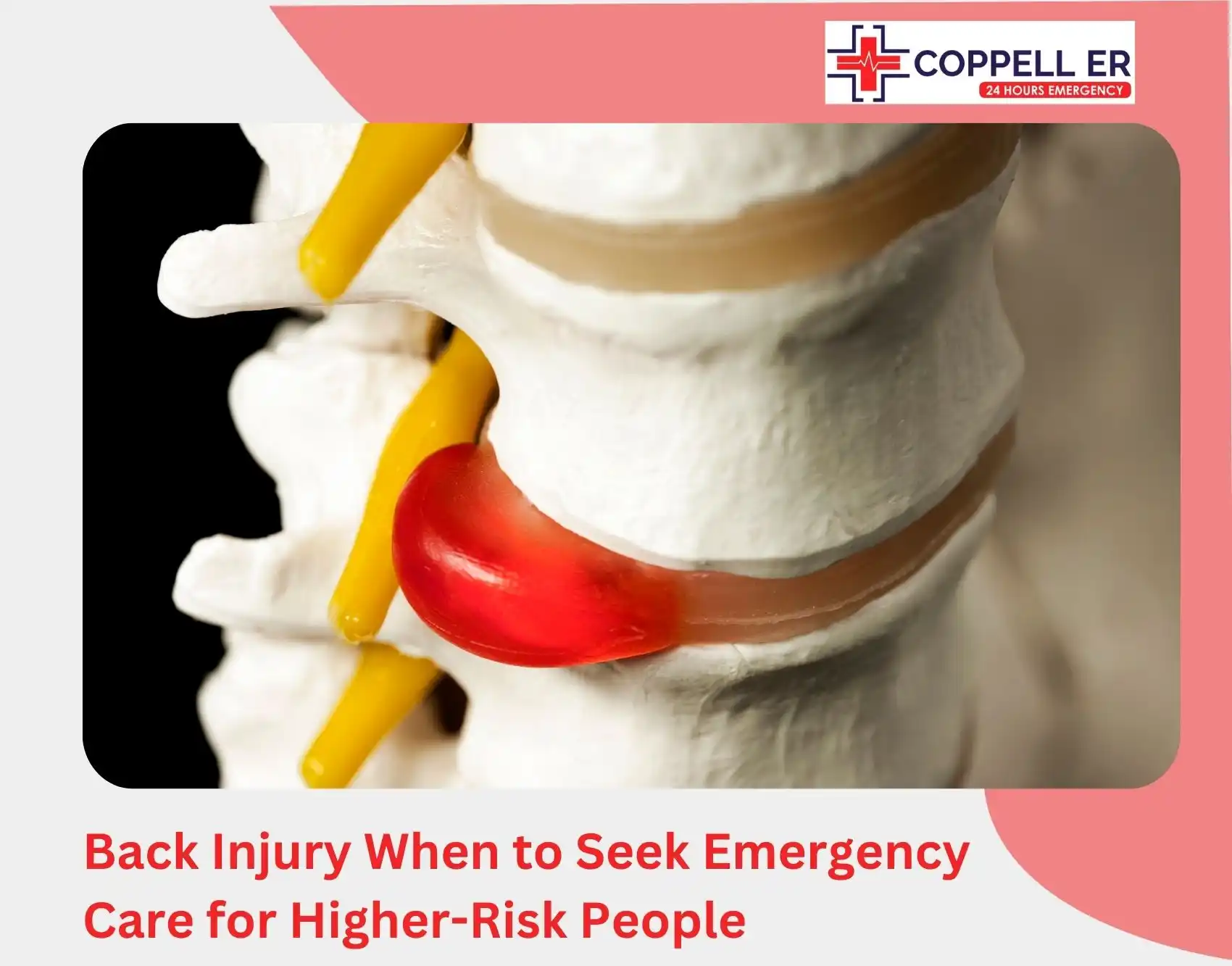 Back Injury When to Seek Emergency Care for Higher-Risk People