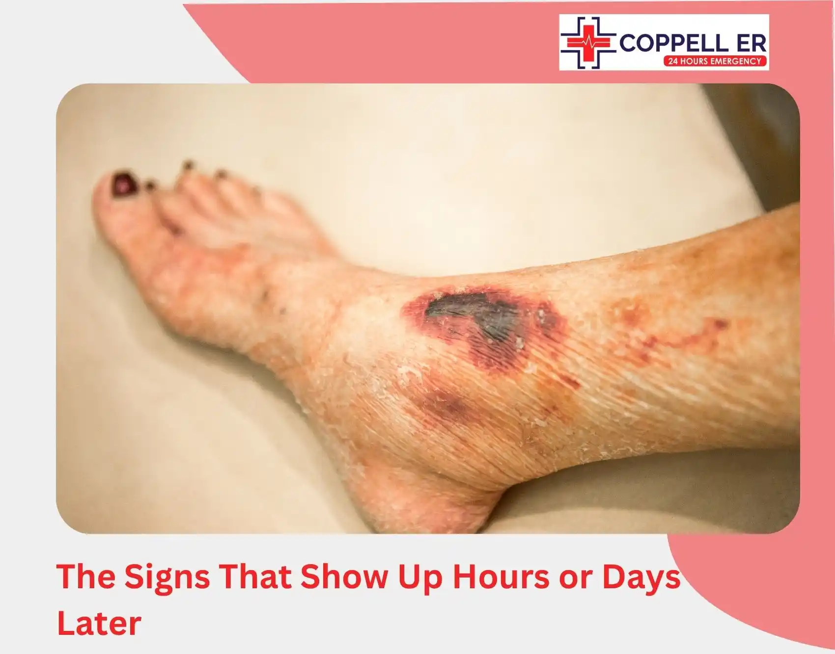 The Signs That Show Up Hours or Days Later