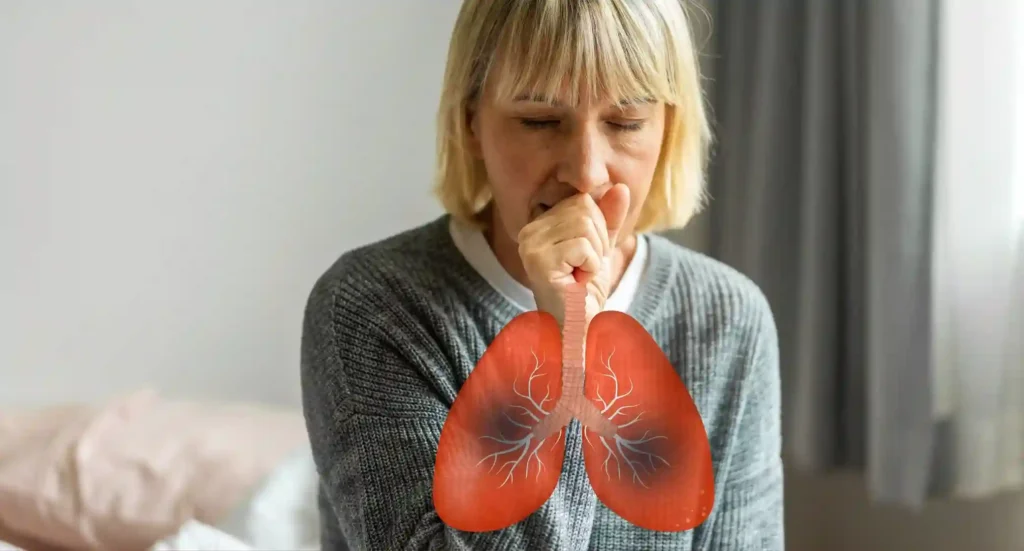 Bronchitis Treatment