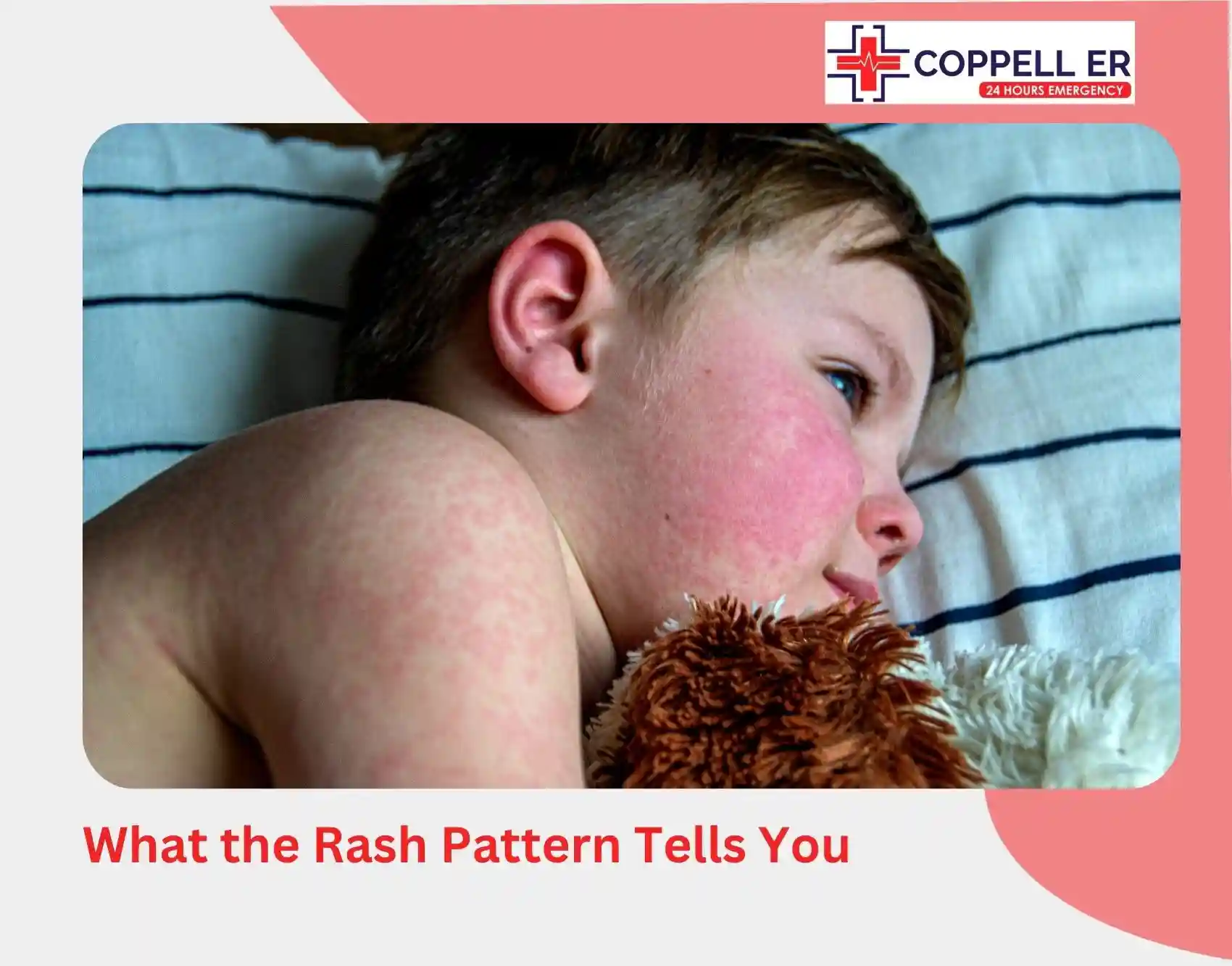 What the Rash Pattern Tells You