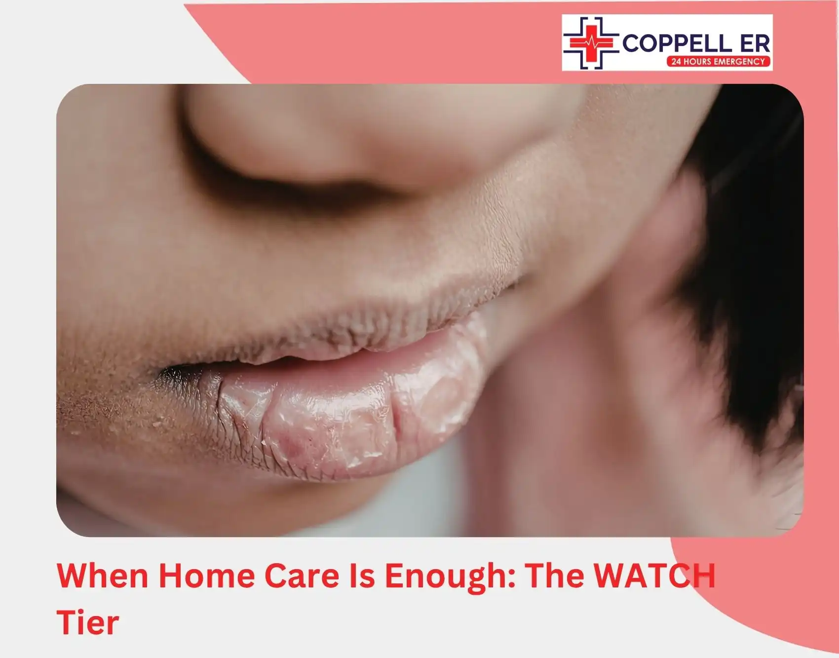 When Home Care Is Enough The WATCH Tier